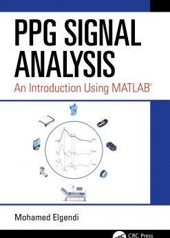 PPG Signal Analysis: An Introduction Using MATLAB® eBook