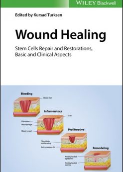 Wound Healing: Stem Cells Repair and Restorations, Basic and Clinical Aspects eBook