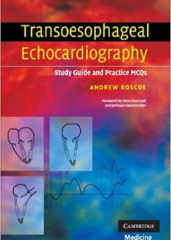 Transoesophageal Echocardiography: Study Guide and Practice MCQs eBook