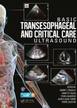 Basic Transesophageal and Critical Care Ultrasound eBook