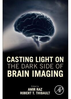 Casting Light on the Dark Side of Brain Imaging eBook