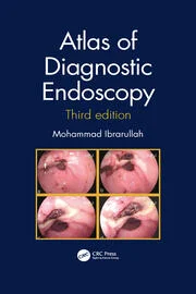 Atlas of Diagnostic Endoscopy, 3E eBook