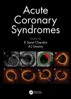 Acute Coronary Syndromes eBook
