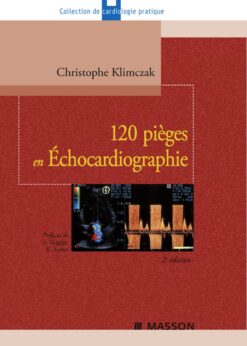 120 pièges en Échocardiographie eBook