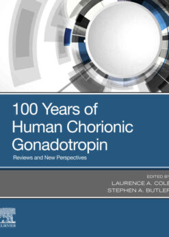 100 Years of Human Chorionic Gonadotropin: Reviews and New Perspectives, 1st Edition eBook
