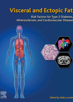 Visceral and Ectopic Fat: Risk Factors for Type 2 Diabetes, Atherosclerosis, and Cardiovascular Disease eBook