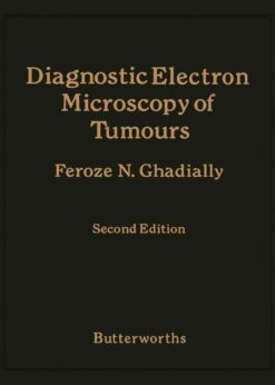 Diagnostic Electron Microscopy of Tumours eBook