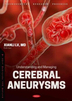Understanding and Managing Cerebral Aneurysms eBook